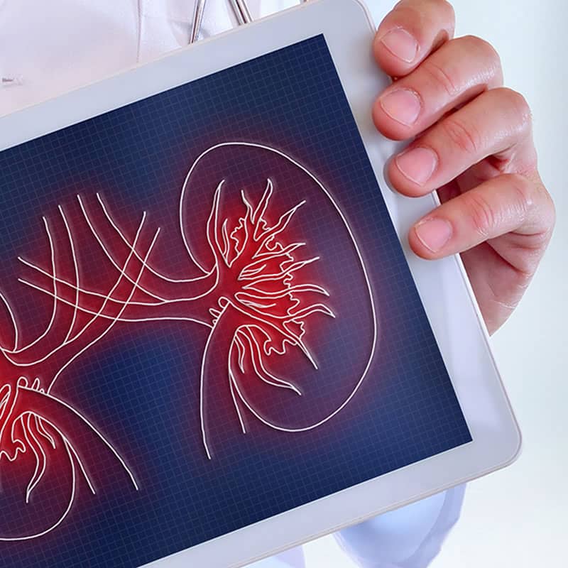 Renal diseases