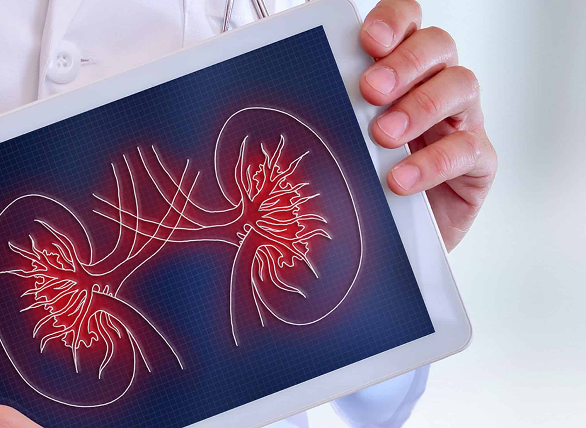 Renal diseases